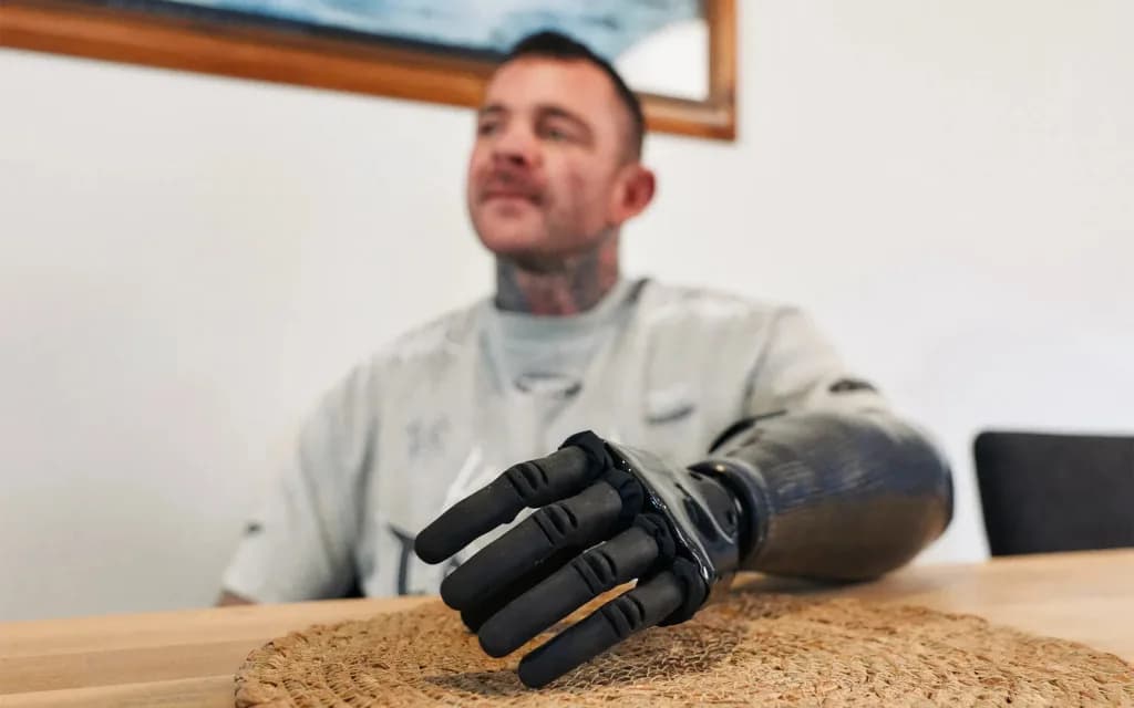Phantom Neuro prosthetic limb